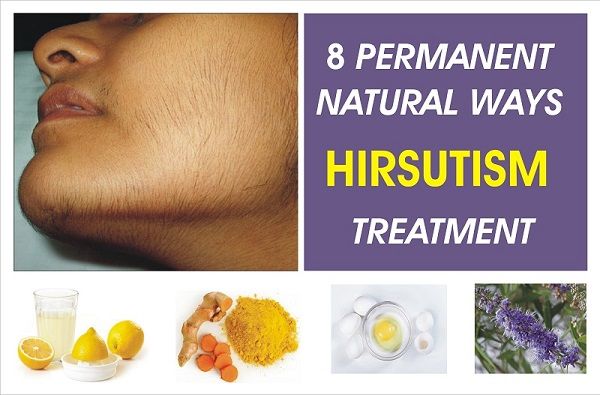 top-8-natural-ways-hirsutism-treatment