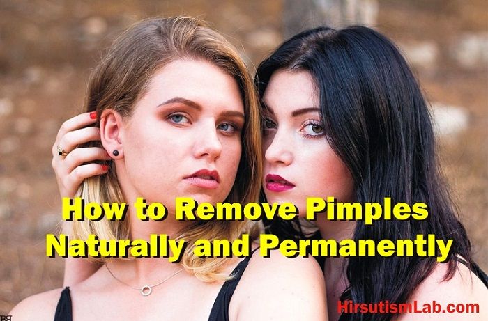 How to Remove Pimples Naturally and Permanently